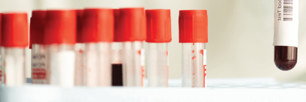 [제공=HLB 홈페이지]