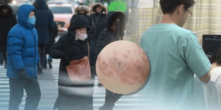 대상포진 [출처=연합]