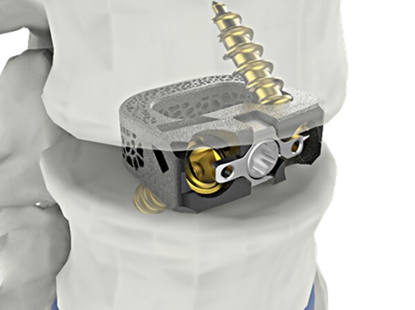[출처=시지메드텍]