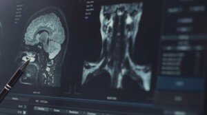 [치매와의 전쟁③] 치료제만큼 귀한 '조기 진단'...빨라지는 K바이오 기... - 뉴스 썸네일 이미지